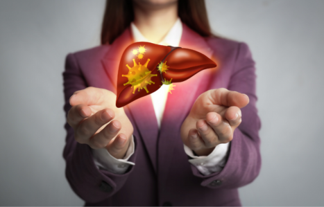 Home Remedies for Fatty Liver disease