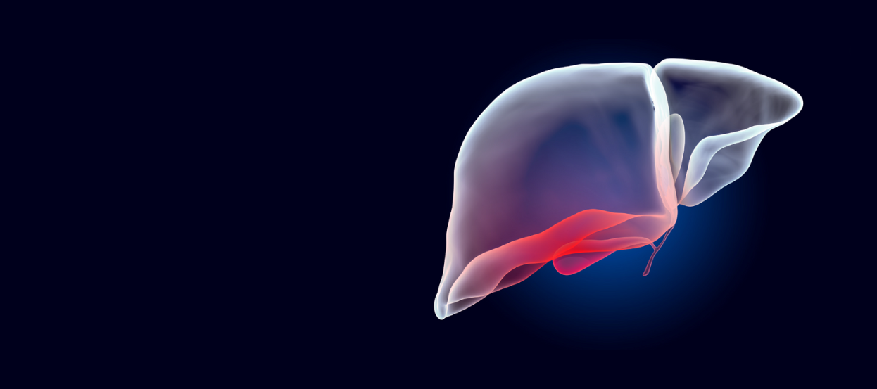 Alcoholic Liver Disease Treatment in Pune, India: Symptoms & Causes