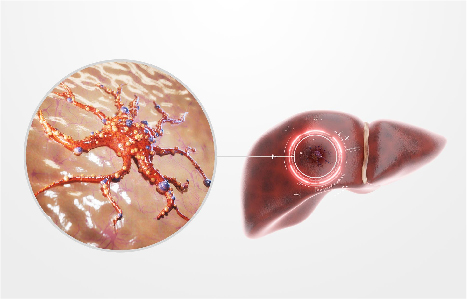 How much does Liver Cancer Treatment Cost in Pune?