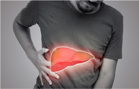 What are the Liver Swelling Causes?