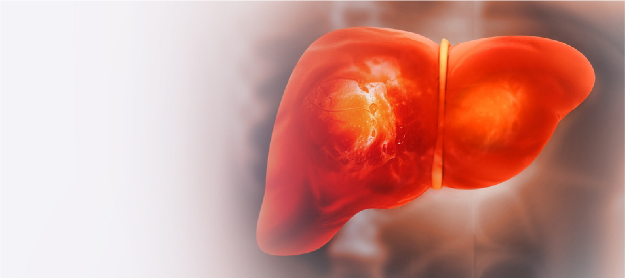 Understanding Liver Inflammation and the Best Ways to Treat It