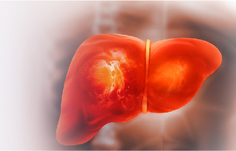 Understanding Liver Inflammation and the Best Ways to Treat It