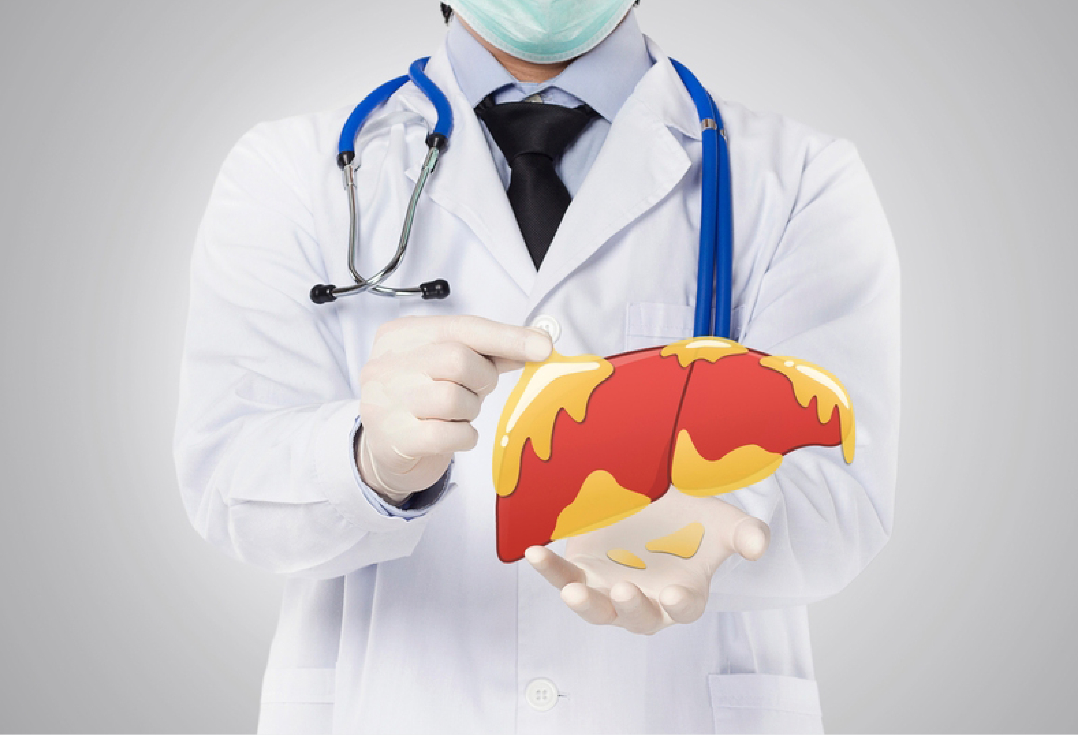 Fatty Liver Grade 3: Symptoms, Causes And Treatment