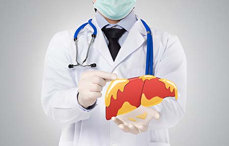 Fatty Liver Disease: Lifestyle Changes To Prevent And Reverse The Condition