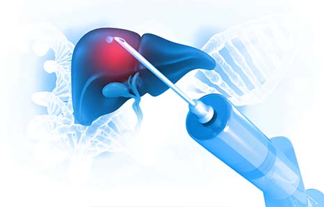 The Benefits Of Robotic Surgery In Liver Tumor Removal