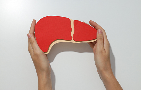 Effective Non-Alcoholic Fatty Liver Treatment in Lucknow