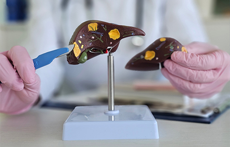 Liver Resection Surgery in Lucknow—Advanced Care & Expertise