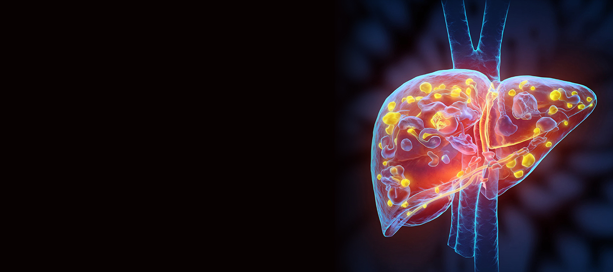 Liver Transplant Rejection: Signs & Prevention Tips