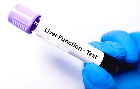 Liver Function Test (LFT) Normal Range: A Complete Guide