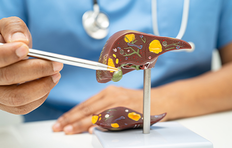 What Is Hepatic Parenchymal Disease? Everything You Need to Know