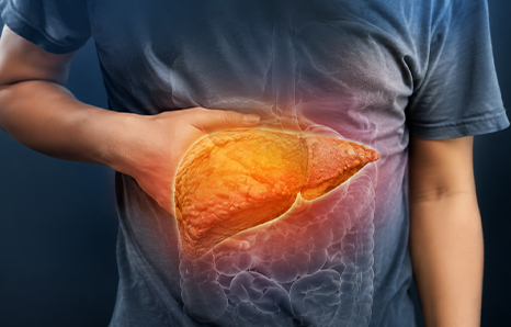 Why Fatty Liver Disease Is Increasing Rapidly in Young Adults
