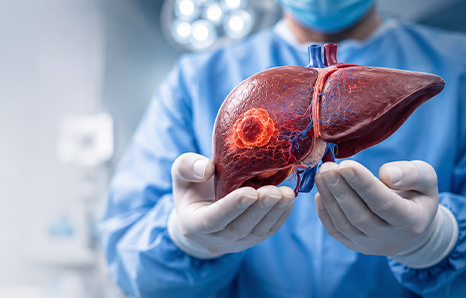 Liver Transplant vs Liver Cancer Surgery: Which One Has Better Survival Rate?